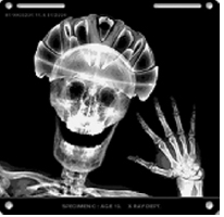 X - ray images